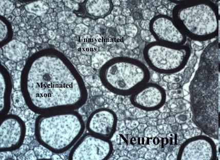 Oligodendrocita Dr H.