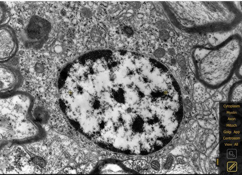 Oligodendrocita Golgi mitkokondriumok axonok myelinhüvellyel Több axonnal