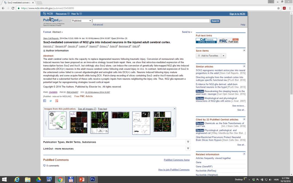 NG2 cells respond to extrinsic