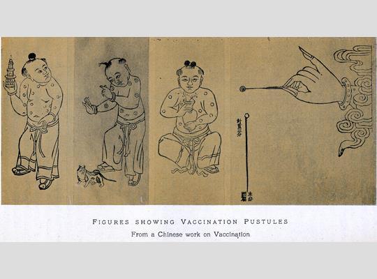 A VÉDŐOLTÁS TÖRTÉNETE http://amhistory.si.edu/polio/virusvaccine/enlargehis_ 01.