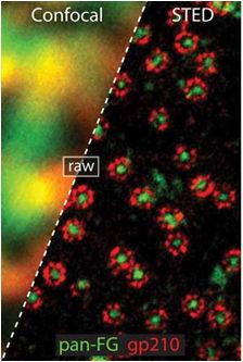 STEDimaging howing two color colocalizedrecording of nuclear pore