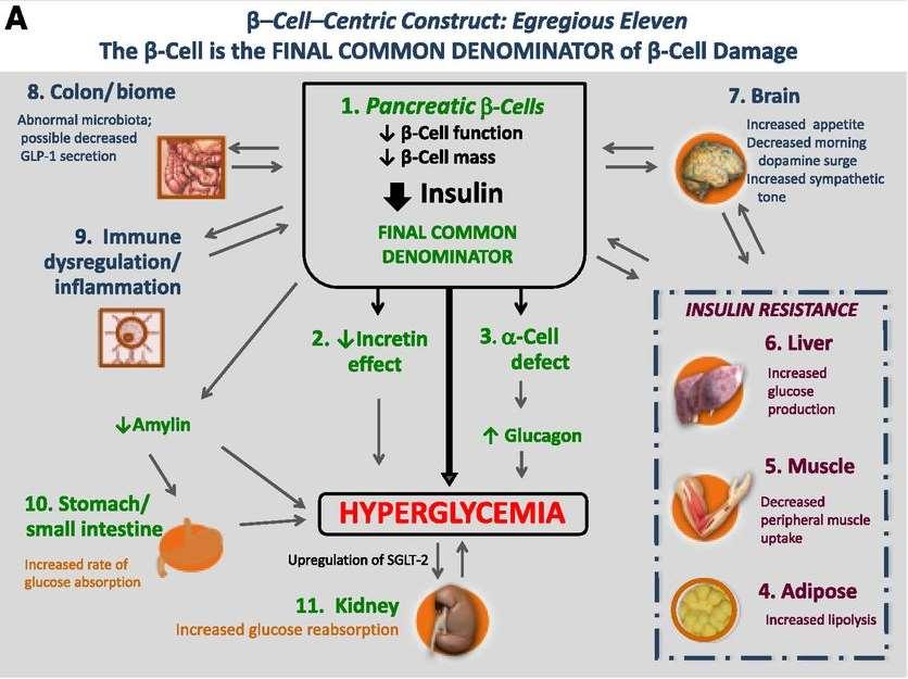 A 2-ES TÍPUSÚ DIABETES PATHOPHYSIOLOGIÁJA 2016 by American