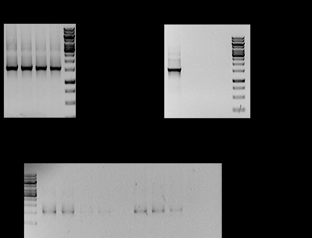Eredmények és értékelésük méretű terméket, igaz jelentősen kisebb mennyiségben, ami a reakció gátlására utalt (23. ábra). 23. ábra Vérszérum PCR gátló hatása.