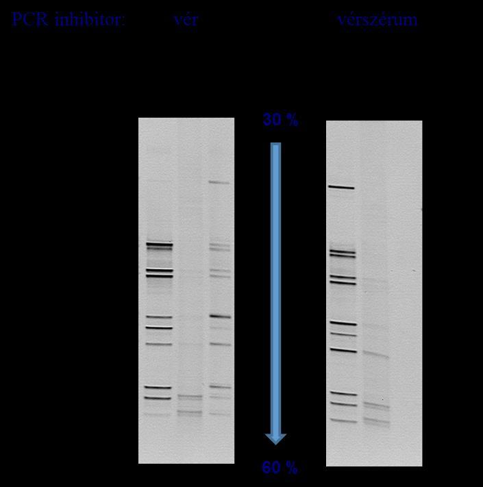 Eredmények és értékelésük 6.5.2. Vér és vérszérum hatása a PCR-DGGE mintázatra A vér és vérszérum esetében a legnagyobb inhibitor rezisztenciát a Phusion enzim esetében mértük.