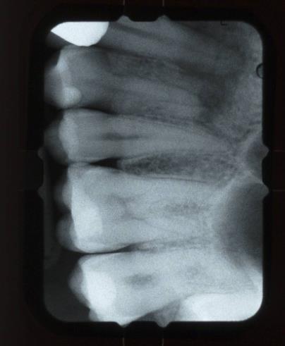 és CBCT