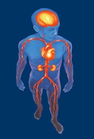 Az atherothrombosis legfontosabb megjelenési formái Ischaemiás stroke Tranziens ischaemiás attack Myocardialis infarktus Renovascularis hypertonia Angina: Stabil