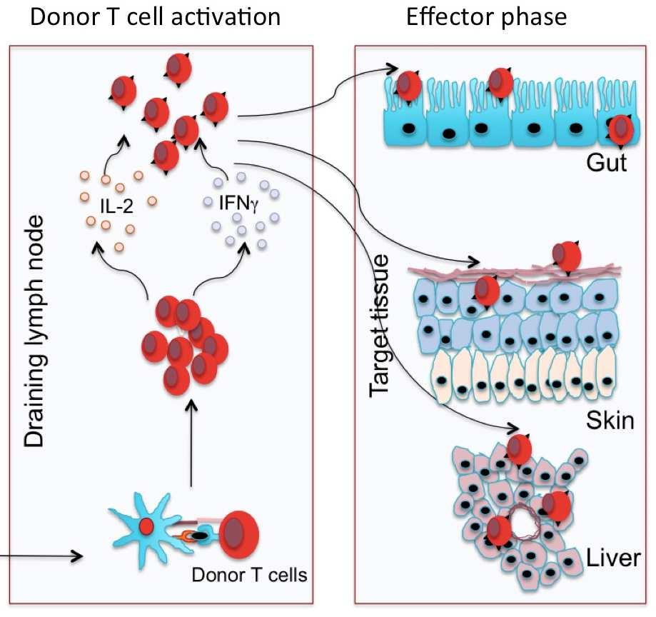 GRAFT VS. HOST DISEASE ("GVHD") Ha csontvelőt transzplantálnak az immunszuprimáltbetegbe, a graftbanlévő donor T sejtek megtámadják a recipiens szöveteit.