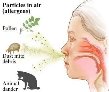 I-es típusú hypersensitivitási raeakció Urticaria: piros viszkető kiütések, foltok Angioedema: előzőnél kifejezettebb, oedemával jár Szénanátha: