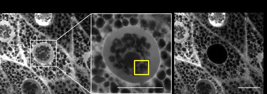 4.4. A Moesin sejtmagon belüli lokalizációjának vizsgálata A Moesin sejtmagon belüli kötődési dinamikai tulajdonságainak vizsgálatához kiboncolt, Moesin-GFP-t termelő nyálmirigyeket használtunk, ahol