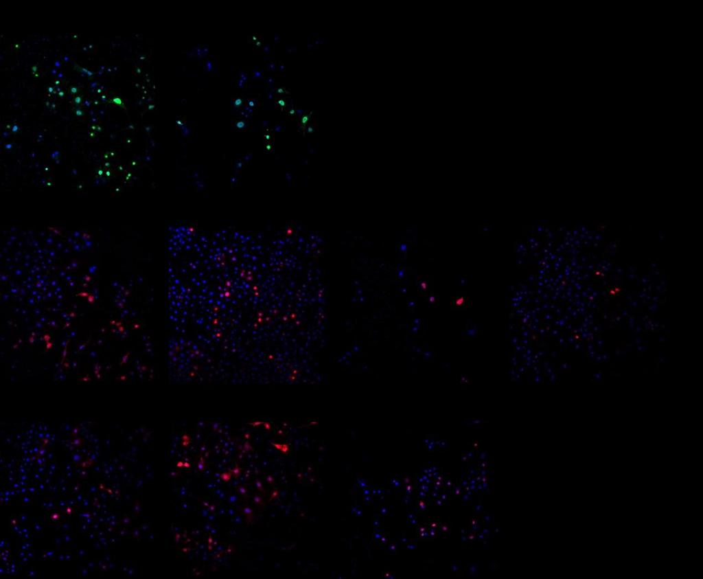 A Jelölt Méret (kda) Epitóp Sbr (NXF1) 76,2 GFP p15 (Nxt1) 15,2 GFP PCID2 45,2 V5 CG2063 (SAP30BP) 36,2 V5 ZC3H3 66,3