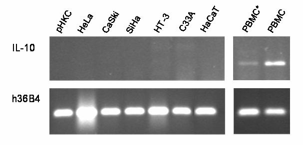 6. ábra Az IL-10 promoter expressziós aktivitása. A keratinocita (phkc, HaCaT) valamint az epiteliális (C-33A, HT-3, CaSki, HeLa, SiHa) sejtekbıl nem volt kimutatható az IL-10 mrns jelenléte.