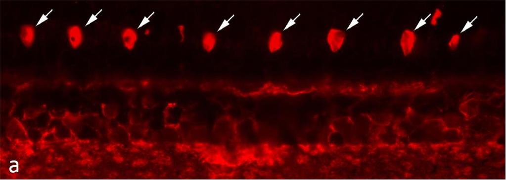 11. ábra. GABA-immunreaktív fotoreceptor sejtek a Pelobates retinában. Aránymérték: 10 μm.