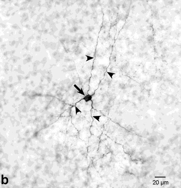 (nyílhegyek), (c) centrifugális rost (nyílhegyek). A neuropeptid Y-pozitív amakrin sejtek térbeli eloszlását is vizsgáltuk egy wholemount preparátumon.