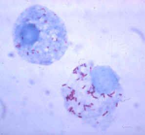 Coxiella genus A C. burnetti a Q-láz kórokozója, ami világszerte elterjedt zoonosis. A vad- és háziállatok kullancsa terjeszti.