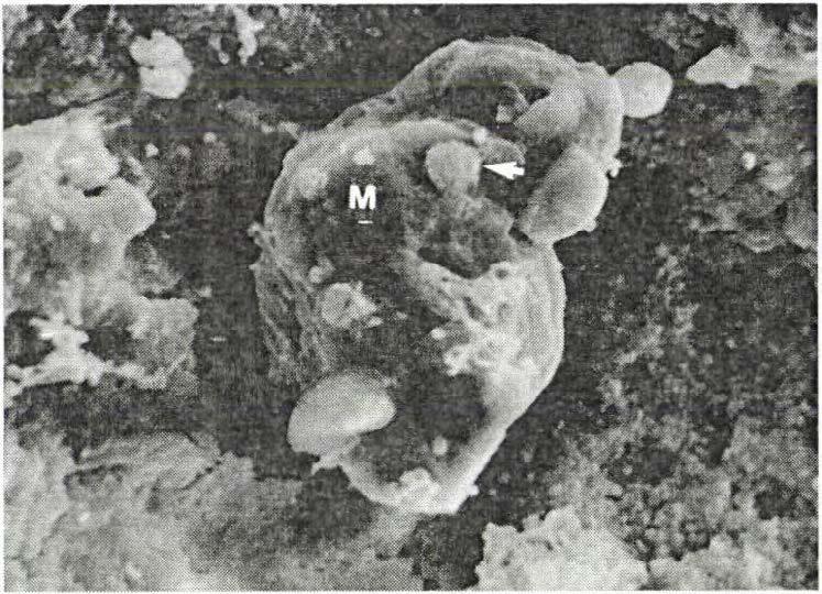 3. ábra: A macrophag sejt (M) felületéhez coccusok (nyíl) tapadnak (3500 x nagyítás).