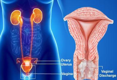 HÜVELYI FOLYÁS Gardnerella vaginalis Szürkés-Zöldes Endometrium carcinoma Húslészerű Allergiás folyamatok Neiserria Gonorrhoea Zöldes-sárgás Méhnyak diszplázia