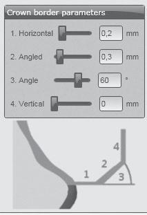 ALKALMAZÁS A szélekre vonatkozó paraméterek a Ceramill Mind CAD-szoftverben Ügyeljen a szélek kielégítő vastagságára. A javasolt értékek a következők: _ 1. A szél vastagsága (Horizontal): 0,2 mm _ 2.