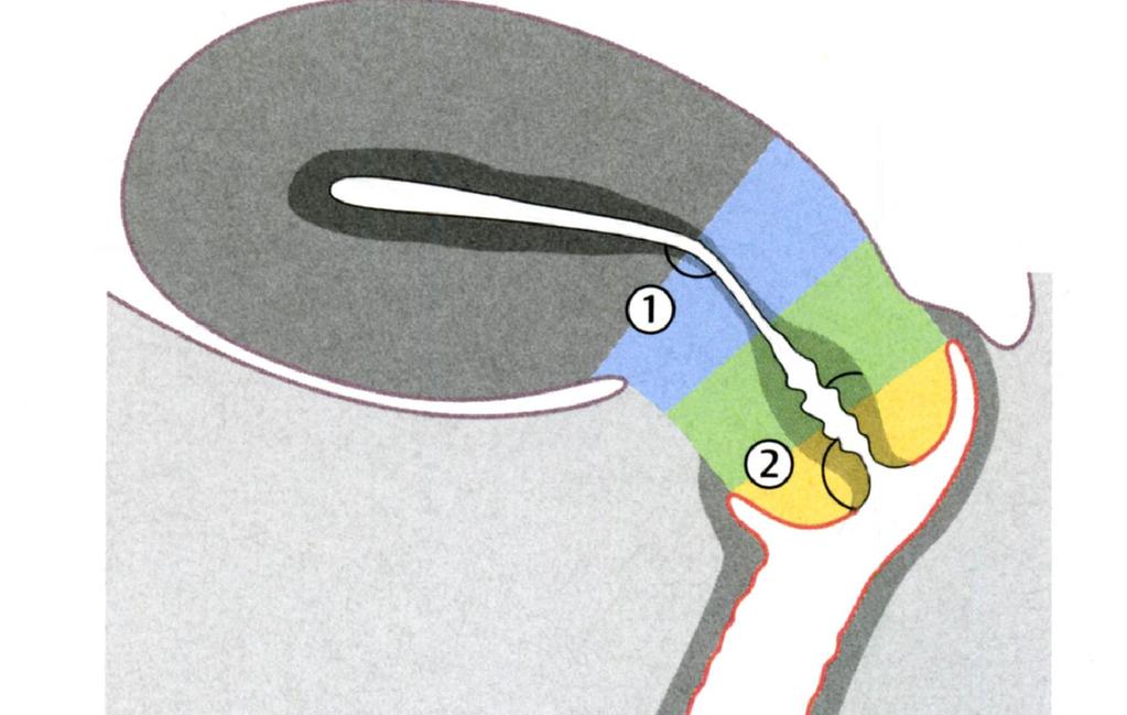 A VAGINA ÉS S A CERVIX KAPCSOLÓDÁSA SA Az uterus anteflexióban (1) és s anteversióban (2).