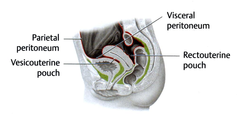 Női i kismedence kötőszk szöveti terei (zöld). A peritoneum piros vonallal jelölve. lve. 1.