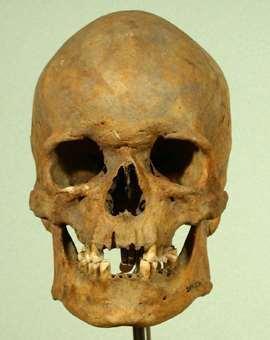 férfi A koponya általános morfológiai eltérései nő Jelleg férfi nő koponyakapacitás átlag 1450