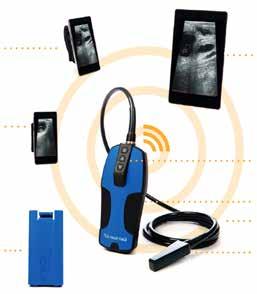 A vezeték nélküli, okostelefonos alkalmazással vezérelhető szkenner egyszerre akár 3 okos készüléken is képes megjeleníteni az ultrahang képet.