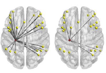 A hippocampus agykéreg kapcsolódási térképe Kontroll Autizmus 1.