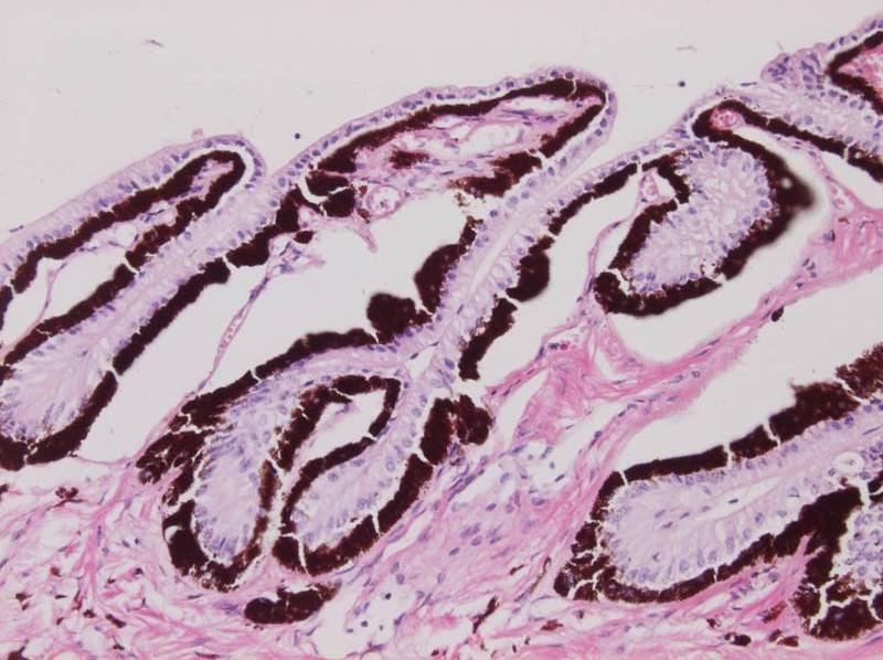 stroma corporis ciliaris epithelium ciliare küls bels