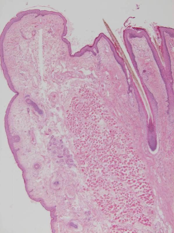 pars cutanea (epidermisszel fedett felszín) m.