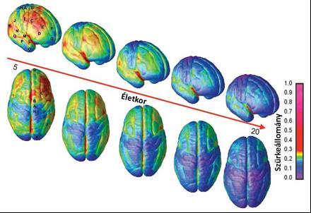a magasabb rendű területek, amelyek a már korábban fejlődő területekről származó információkat is integrálják. 7. ábra: Az ábra a szürkeállomány térfogatváltozásának MRI felvételeit mutatja.