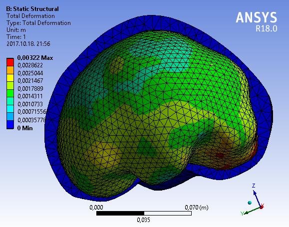 kialakított geometriának köszönhetően. Az agyszövet megduzzadt a IV.3.