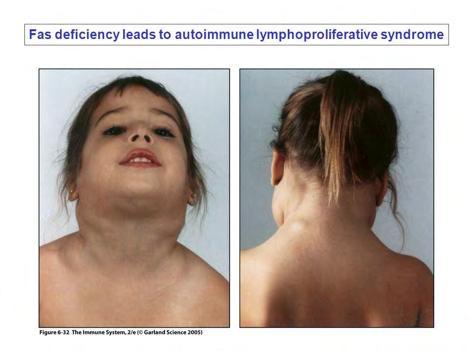 Apoptosis defektusai: Kontrollálatlan lymphoproliferáció