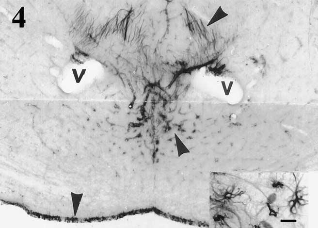 A gliaszerkezet evolúciós tendenciái II. 3. ábra Tüskéscápa, denz agyi ependymoglia. Lépték: 90 µm.