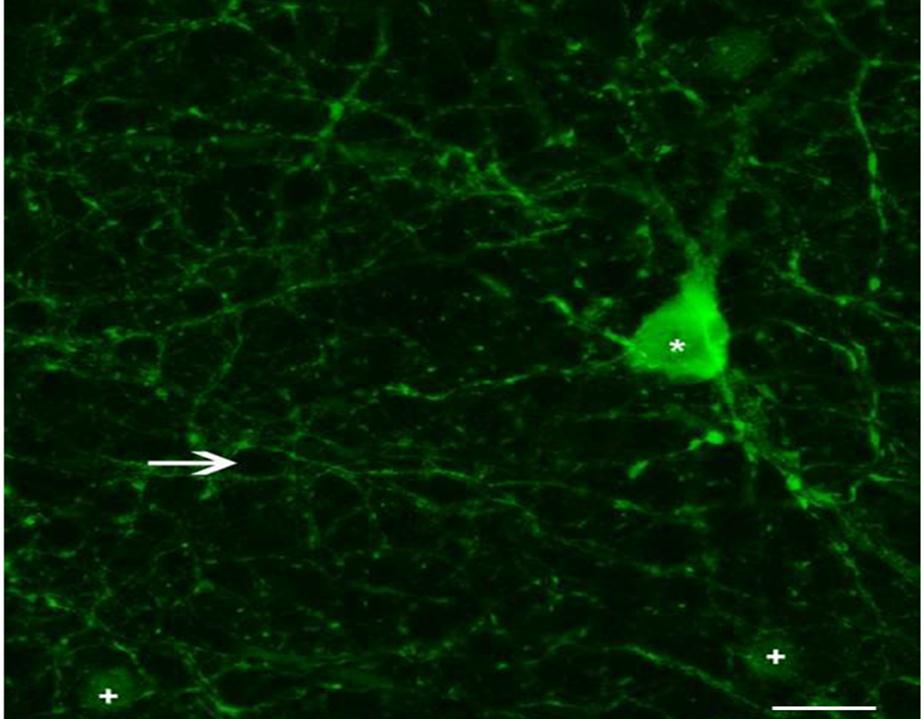 3. ábra Patkány retina whole mount-on az 1-es típusú (csillag), valamint a 2-es típusú (+) TH+ amakrin