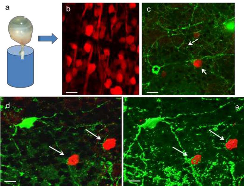 19. ábra Az izolált egérszem látóidegét 4% Neurobiotint (NB, a gap-junction-ökön átjutó neuronális tracer) tartalmazó retina Ringer oldatba helyeztük 15 percre (a). (b).
