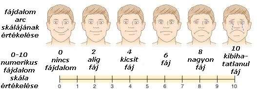 Fájdalom felmérése