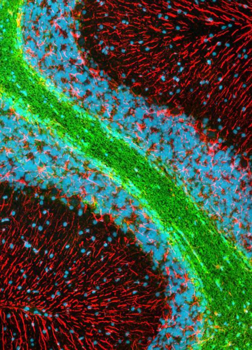 transplanted with human precursor cells. Since the mutant mouse s own cells cannot make MBP, (shiverer) all the myelin has been produced by the human cells.