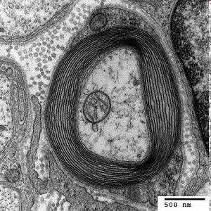 myelinált axon, Schwann