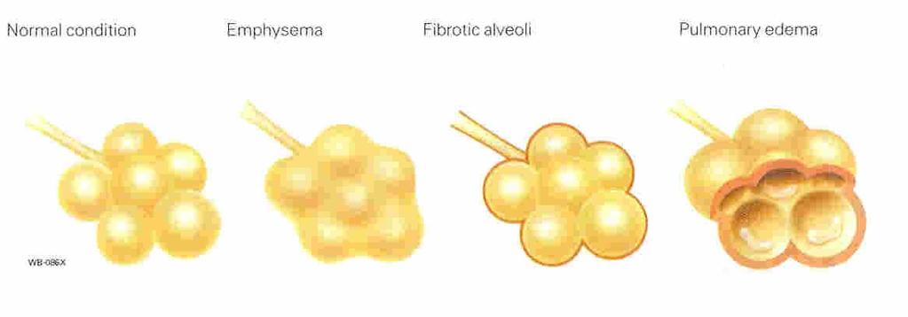 Alveolaris gázcsere alveolaris diffusiót befolyásoló tényezők
