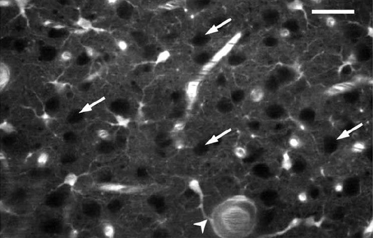imaging of cortical astrocytes at a 250