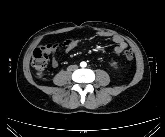 01: stable disease 2016.