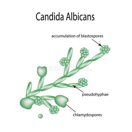 CANDIDA FERTŐZÉS GOMBÁS HÜVELYFOLYÁS Kórokozó: Candida