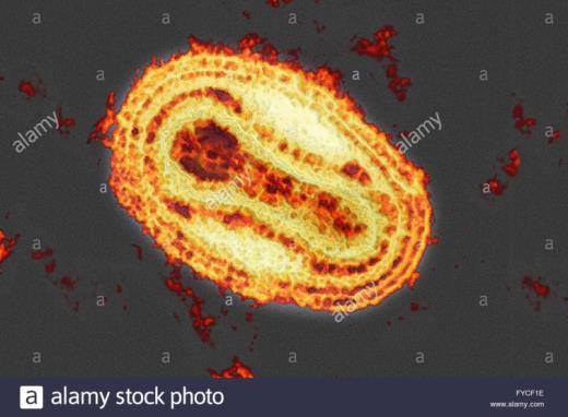 MOLLUSCUM CONTAGIOSUM (USZODAI SZEMÖLCS) Kórokozó: - molluscum contagiosum