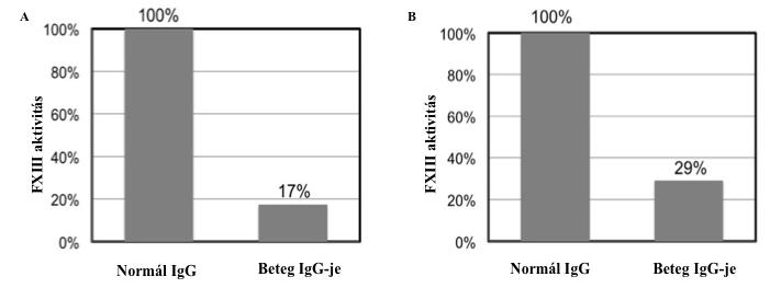 A beteg IgG-je a normál IgG-hez viszonyítva 29%- ra csökkentette az FXIIIa aktivitását (71%-os gátlás, 28. B ábra)