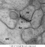 Neurotranszmisszió, szinapszisok működése Piramissejt: glutamát
