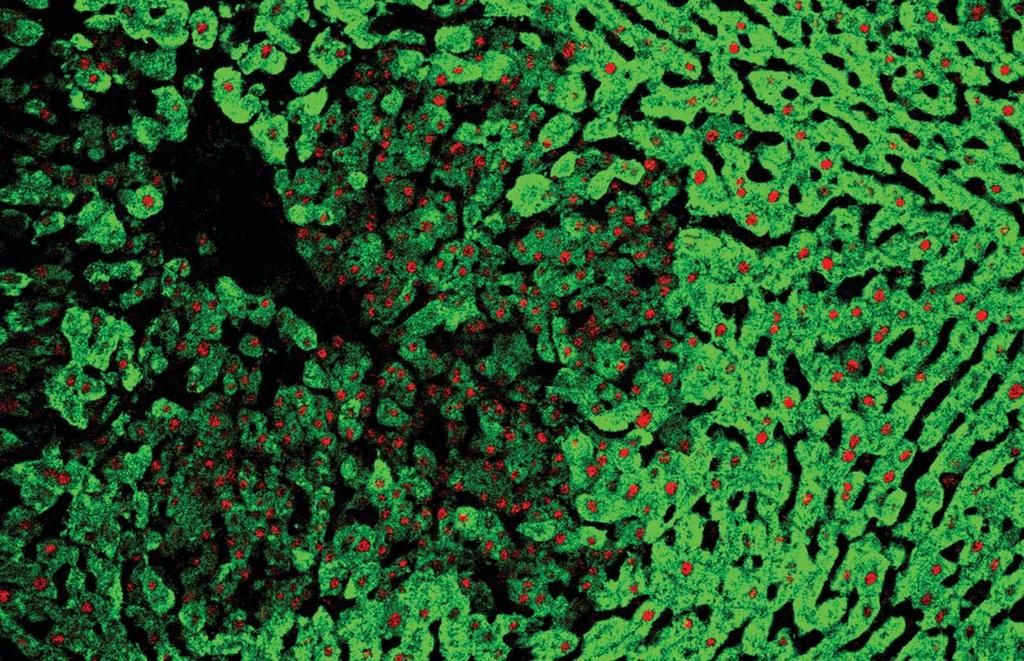 kezelés Relabáló epithelialis petefészekrákok Melanoma Világossejtes veserák