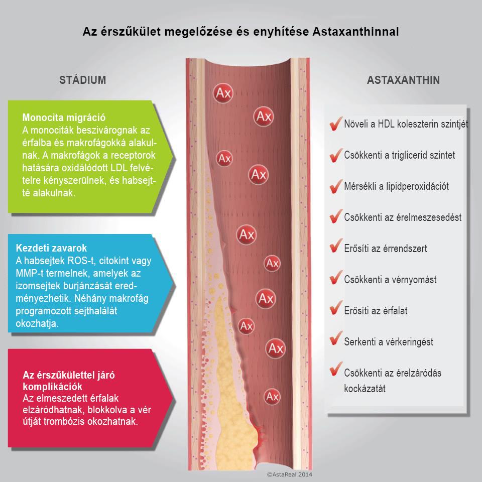 Szívünk egészségért Számos járványügyi és klinikai tanulmány támasztja alá, hogy a diszlipidémia felelős az érfalak megvastagodásáért, amely a szív- és érrendszeri betegségek egyik legnagyobb