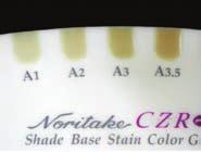 Az égetési paraméterek megtalálhatóak az égetési táblázatban a 26. oldalon. A Shade Base Stain Color Guide-dal ellenorizzük a fogszínt.