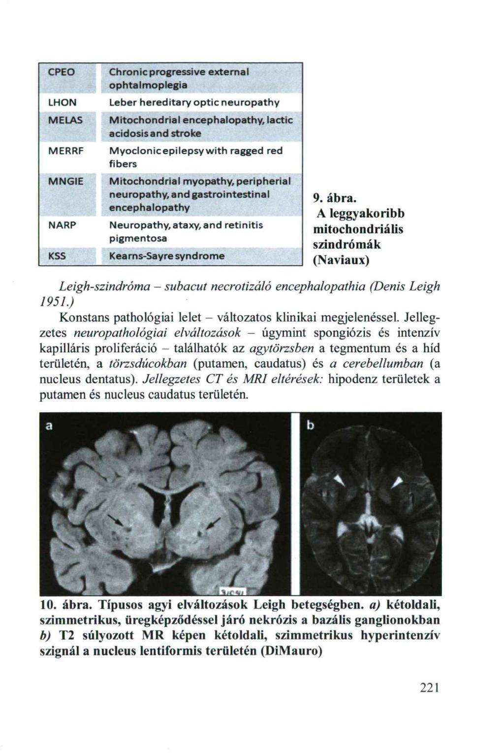 CPEO Chronic progressive external ophtalmoplegia LHON MELAS Leber hereditary optic n e u r o p a t h y M i t o c h o n d r i a l encephalopathy, lactic acidosis a n d stroke MERRF M y o c l o n i c e