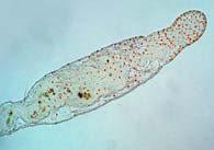 Annelida - gyűrűsférgek Testfelépítés triploblasztikus állatok coeloma (deuterocoeloma) (a testfal és a bélcsatorna között, kivéve, a