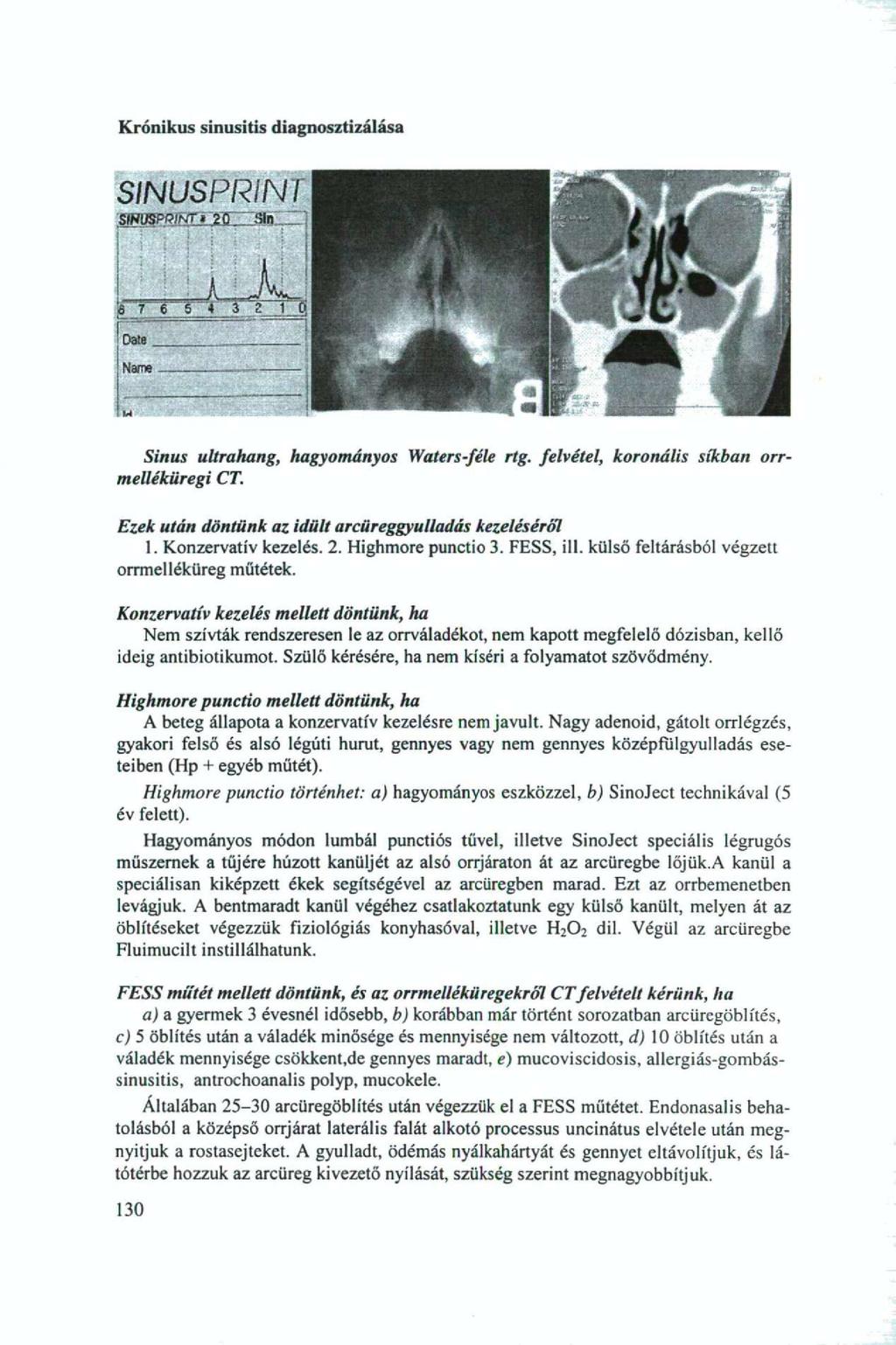 Krónikus sinusitis diagnosztizálása SINUSPRINÍ SJNUSPQINT,. 2 0..311»:. I Sinus ultrahang, hagyományos melléküregi CT. Waters-féle rtg.